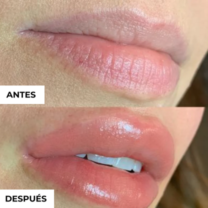 HighPrincesa™ Voluminizador de Labios con Ácido Hialurónico
