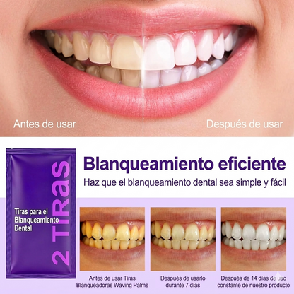 HighPrincesa™ Tiras Dentales Efecto Blanqueador