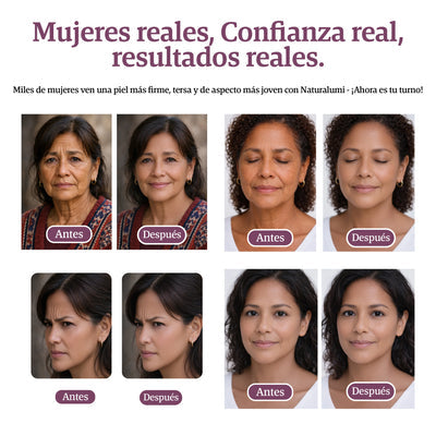 Dr.Melaxin-Barra de colageno Anti-Arrugas —  Elimina Arrugas y Líneas de Expresión