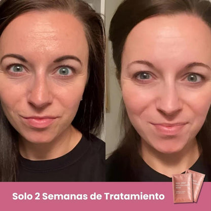 HighPrincesa™ Mascarillas de Biocolágeno – Pack de 25